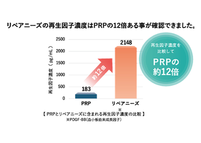 PRPとリペアニーズに含まれる手生因子濃度の比較